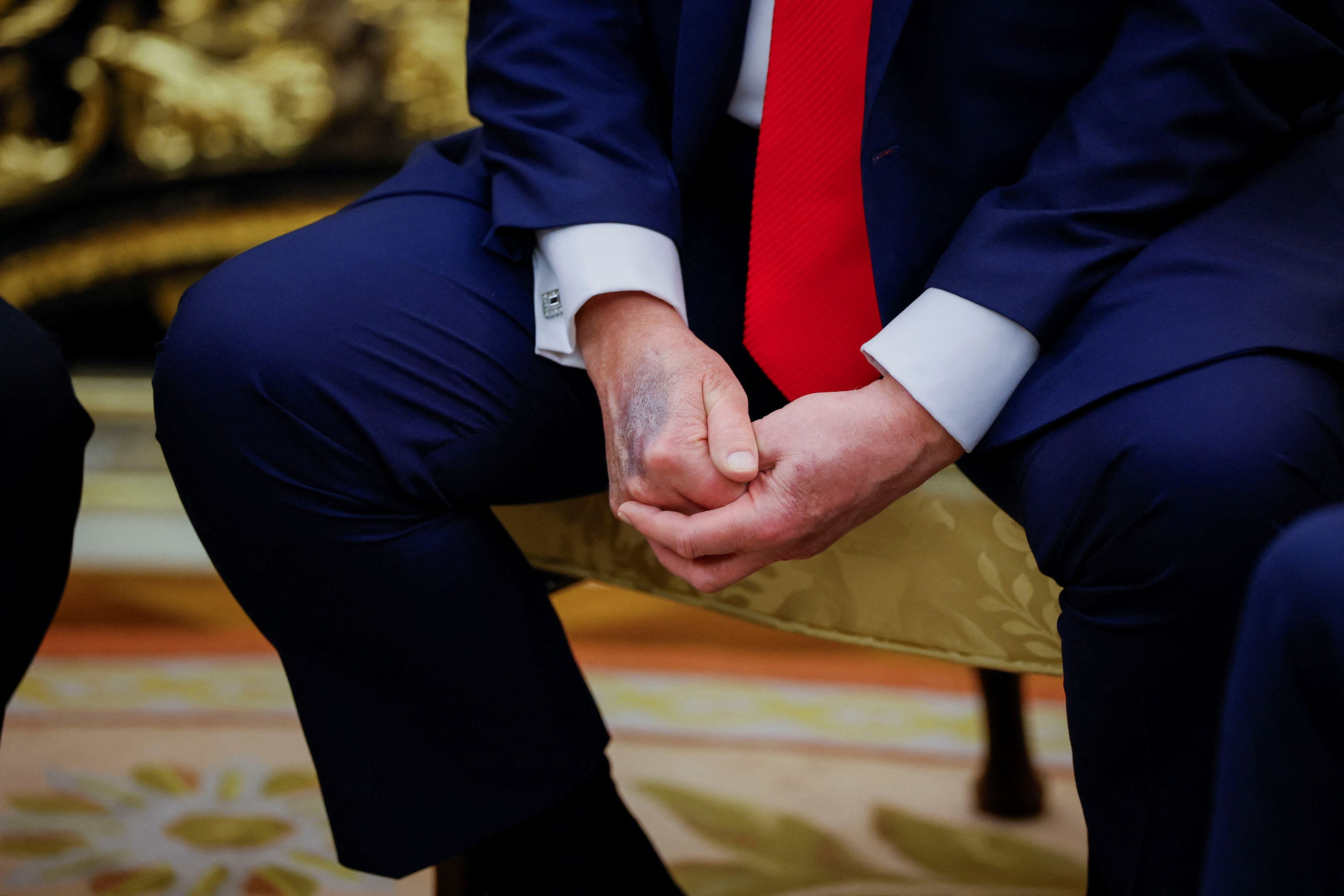 Der blaue Fleck verbreitete sich in Windeseile im Internet. 