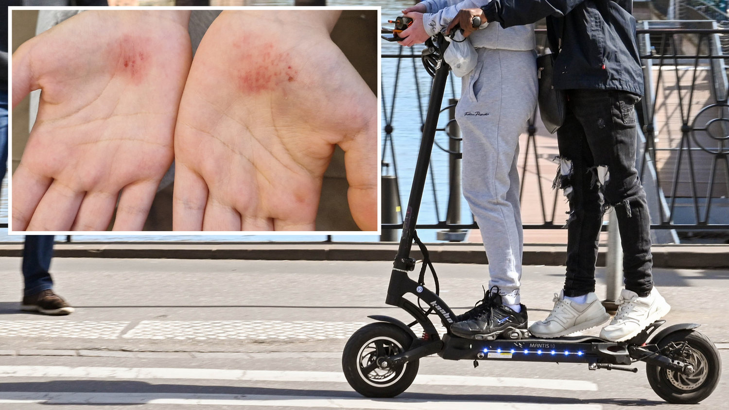 Heute.at - Fahren wie Verrückte: Papa sauer nach E-Scooter-Crash