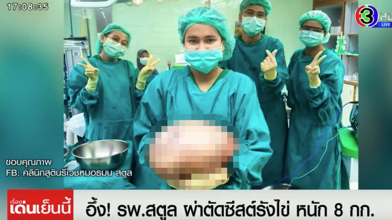 Heute.at - Frau dachte, sie sei dick – Ärzte entdecken Riesentumor