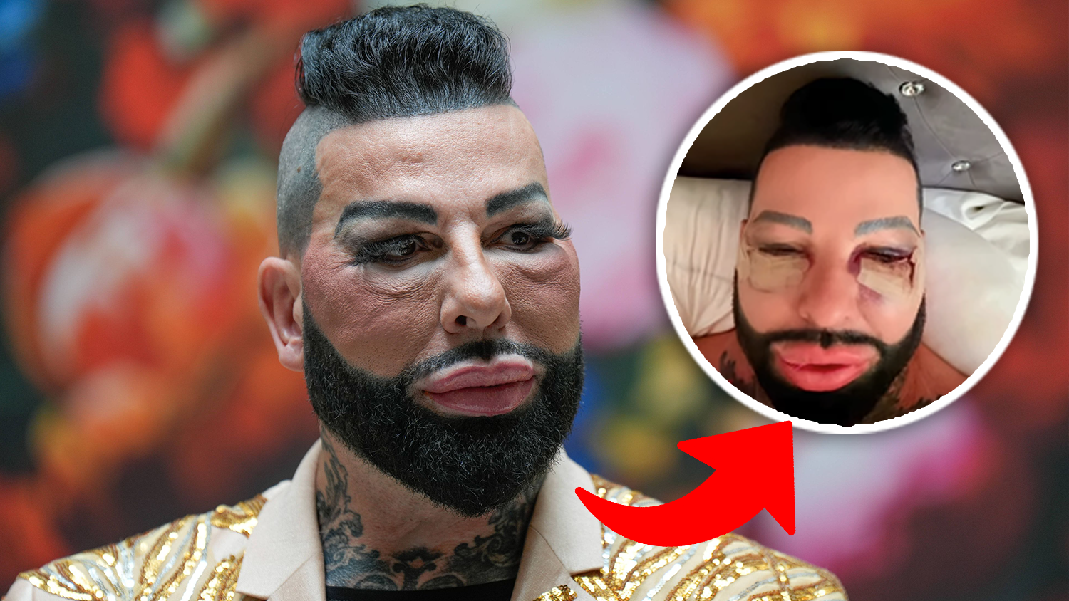 Glööckler schockt Fans mit neuem Gesicht.