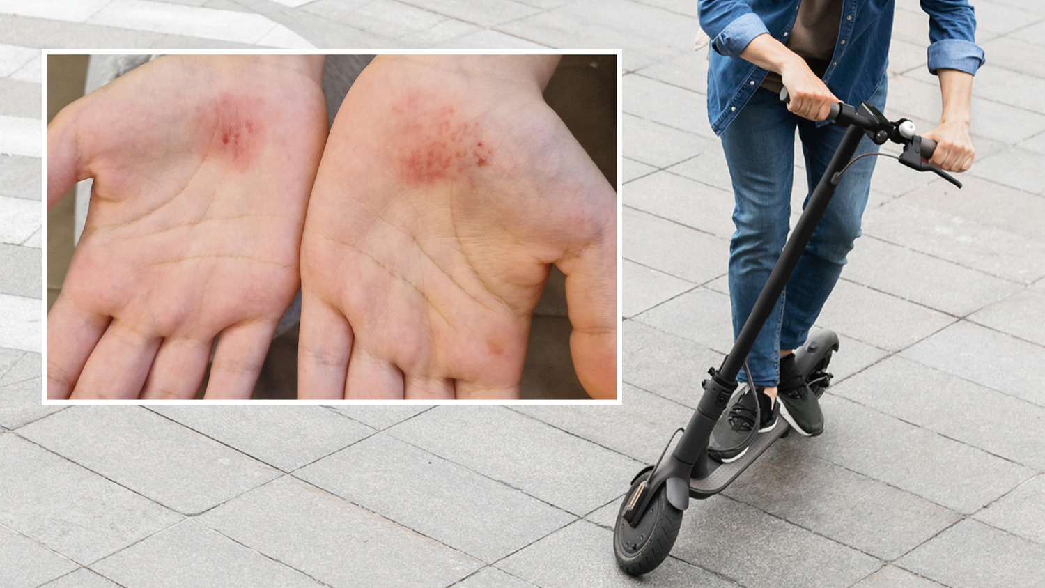 Nach dem E-Scooter Unfall in Traun (Bez. Linz-Land), bei dem eine 14-Jährige verletzt wurde, gehen die Wogen im "Heute"-Forum hoch. (Symbolbild)