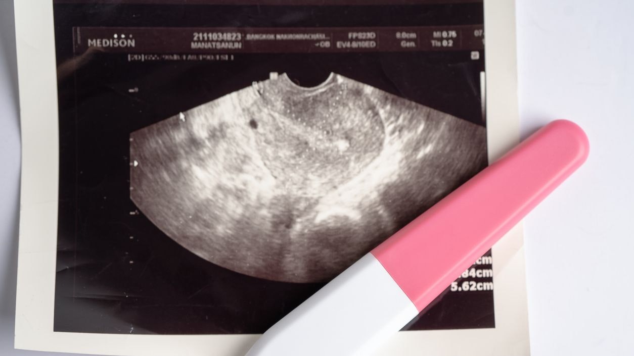 Heute.at - Kostenlose Abtreibung – in unserem Nachbarland geht das