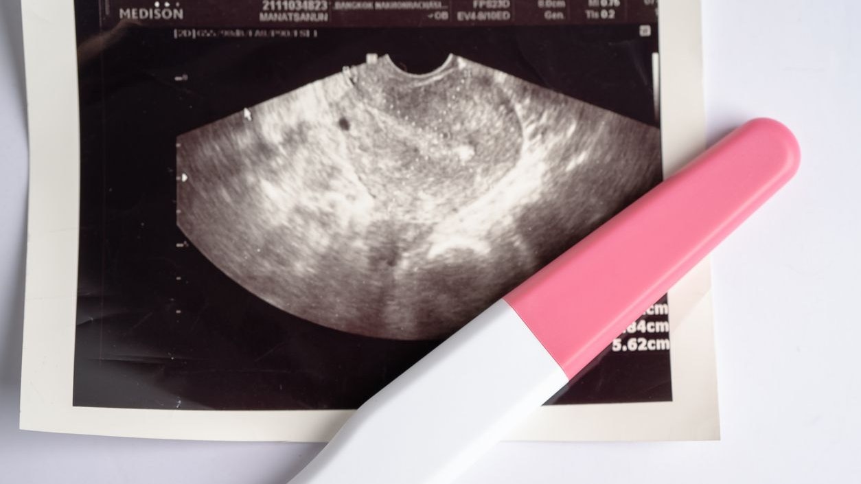 Pregnancy test with ultrasound scan of baby uterus, contraception health and medicine.