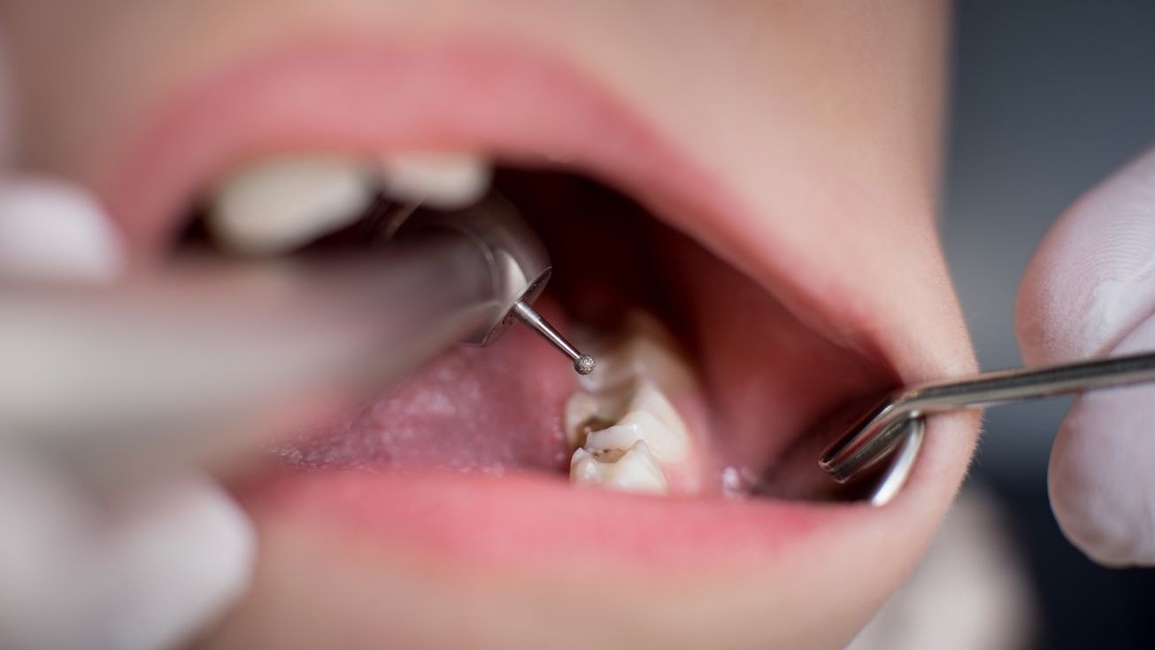 Heute.at - Zahnarzt behandelt Mann, will dann plötzlich 150 Euro