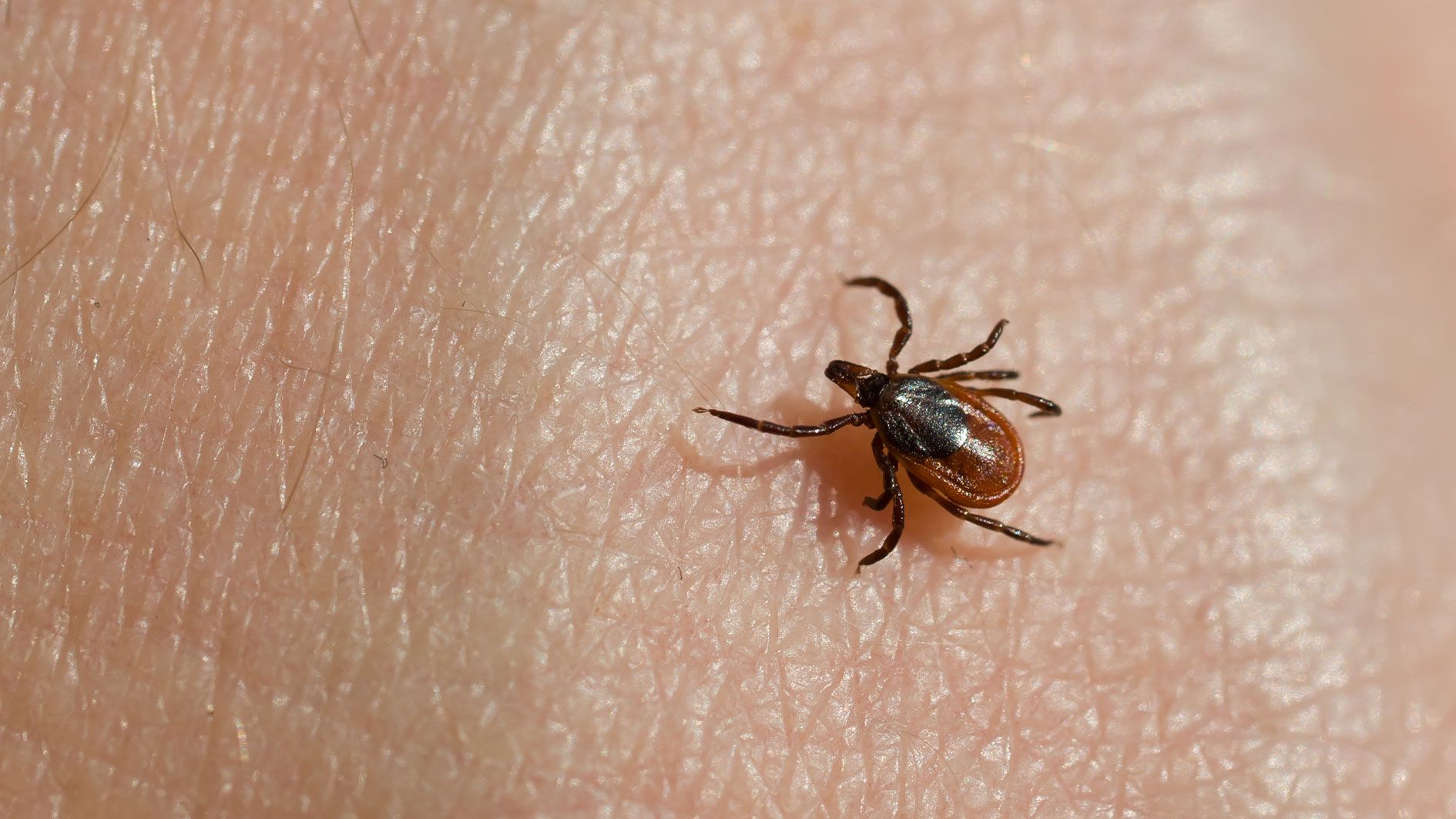 Die Infektionskrankheit ist in Österreich nicht meldepflichtig.