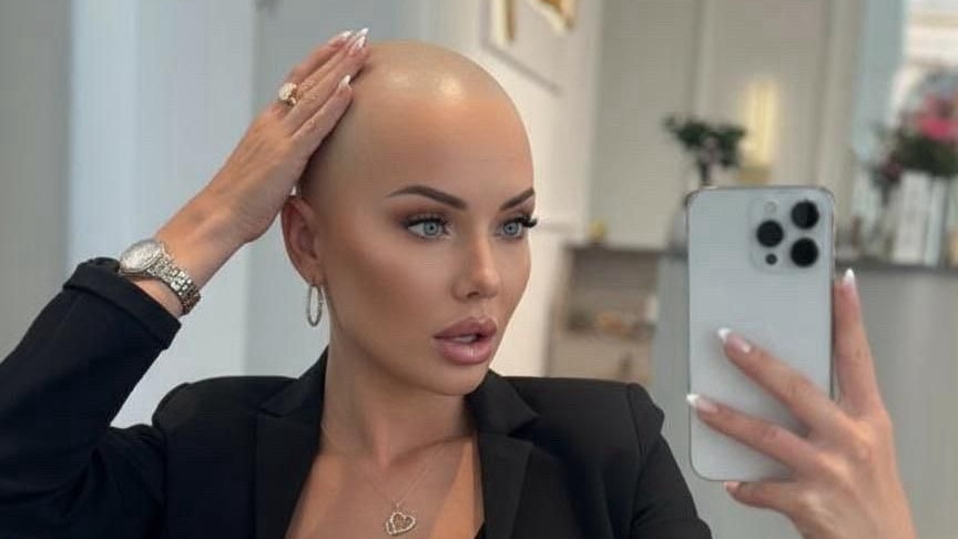 Heute.at - Wahrheit über die Glatze – Wlk veräppelt eigene Fans