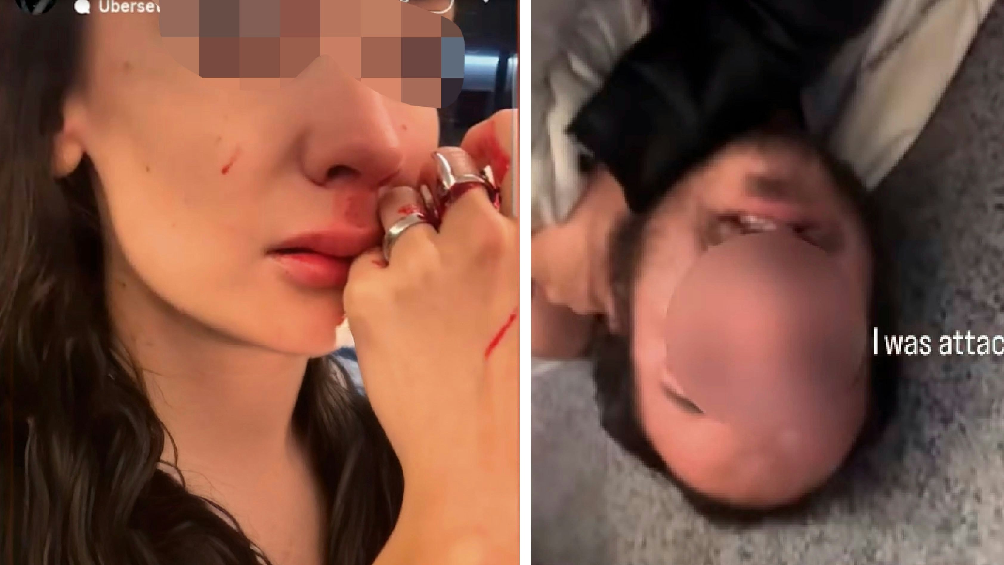 Heute.at - Frau in Tram blutig geschlagen – Polizei hat keine Zeit