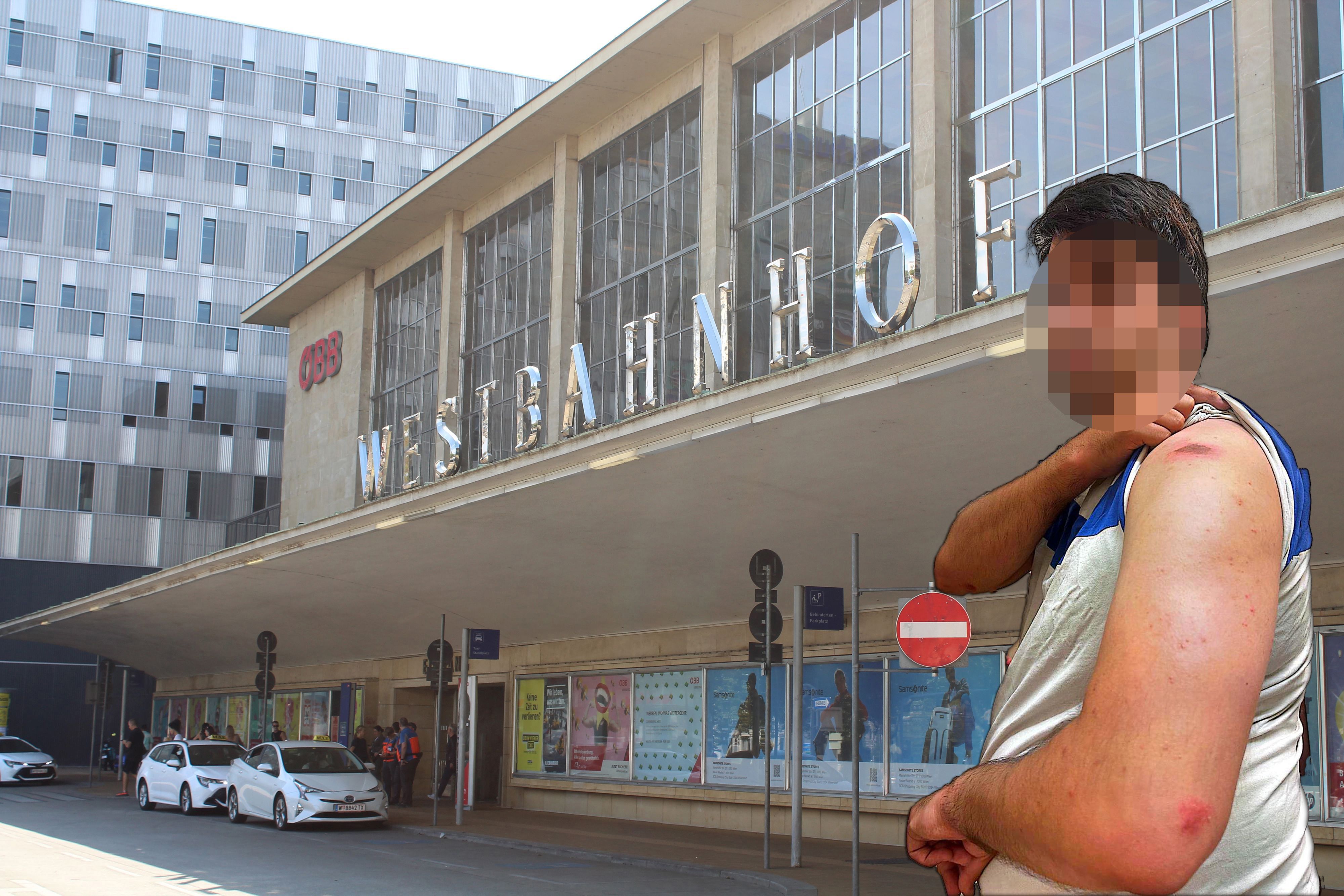 Taxifahrer Ahmad R. (39) zeigt seine Verletzungen nach dem Polizeieinsatz am Westbahnhof.