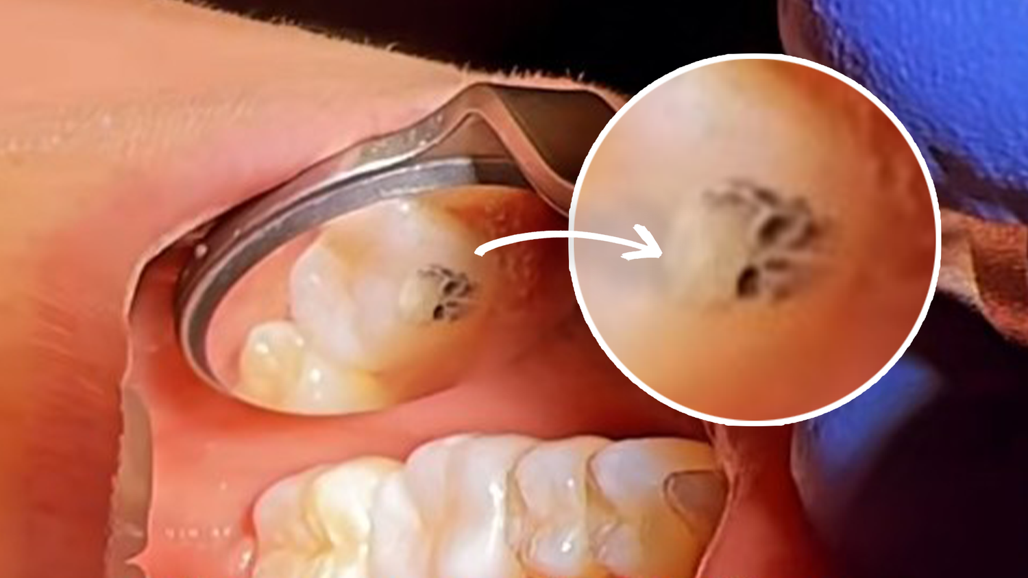 Pimp your teeth: Nach den Steinchen kommen nun die Zahntattoos.