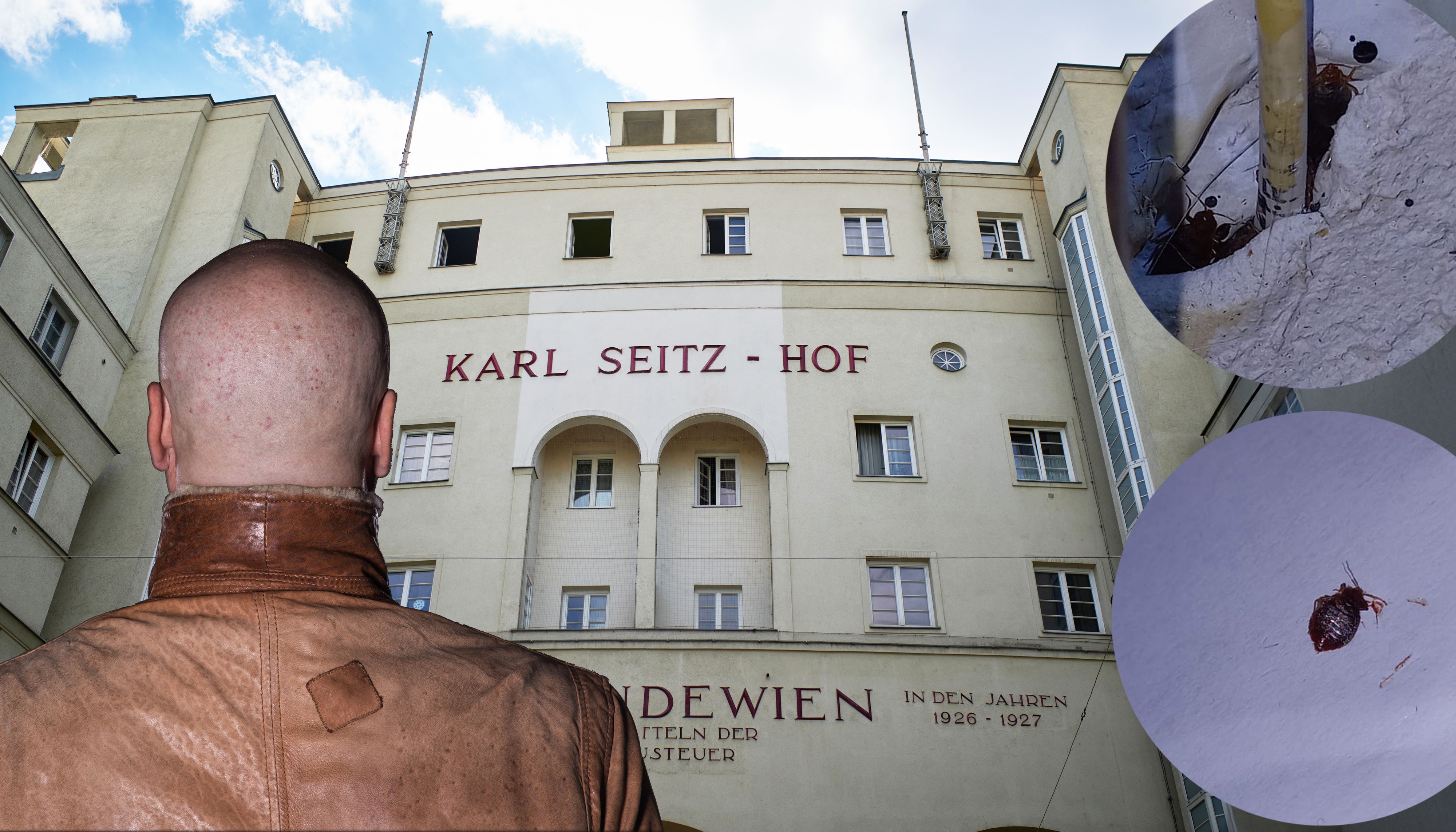 Albtraum: Weil die Parasiten bis in seine Haare krochen, griff der 58-Jährige (Symbolbild) zum Rasierer – jetzt lebt er mit Glatze.