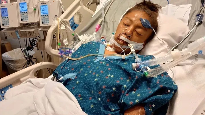 Janelle Scott befindet sich seit dem Vorfall im Krankenhaus.