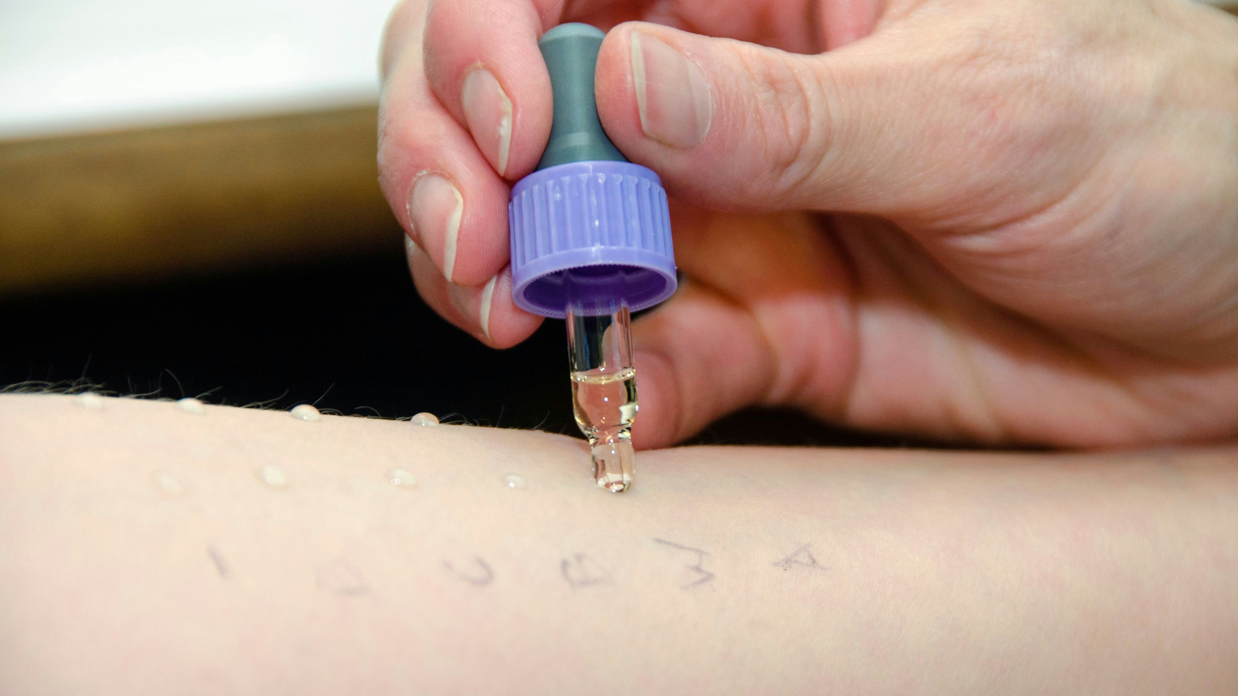 Heute.at - So lang sind aktuell Wartezeiten auf einen Allergietest