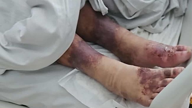 Mirellas Wunden waren lebensbedrohlich.