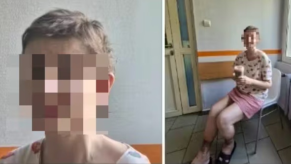 Auf der Spendenseite pomagam.pl berichten Unterstützer von Mirella, dass sie in all den Jahren, in denen sie eingesperrt war, nie einen Arzt aufgesucht habe.