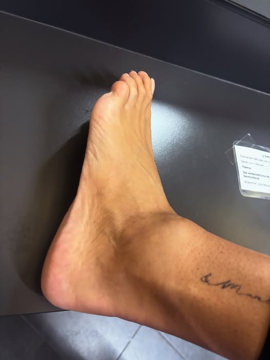 Martina Reuter zeigt ihren angeschwollenen Knöchel