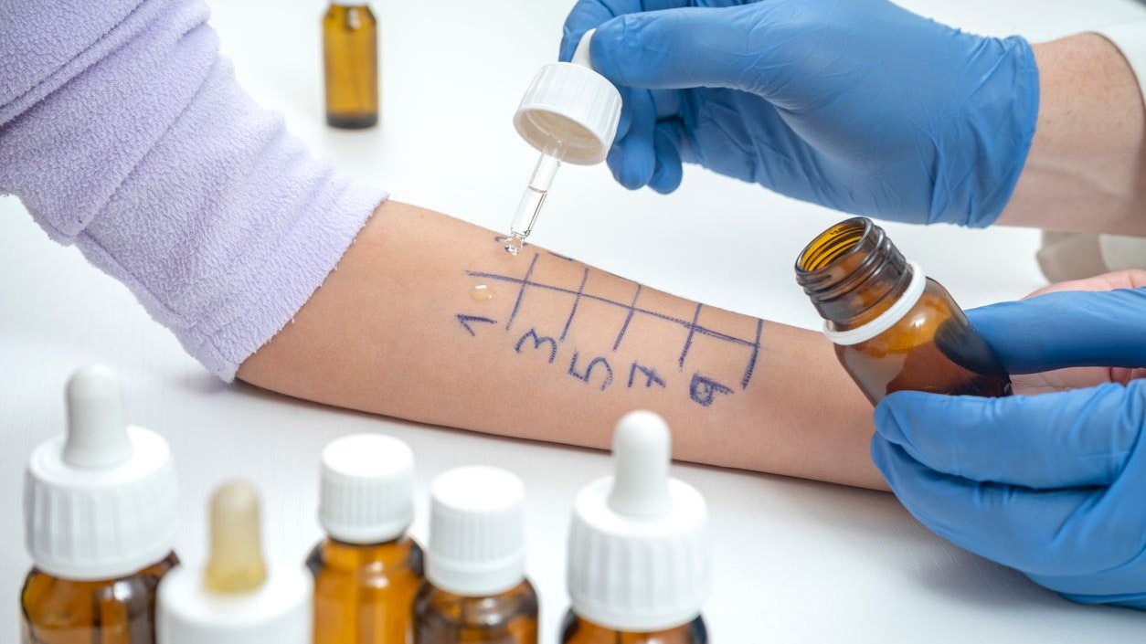 Heute.at - Ja, man kann gegen andere Menschen allergisch sein