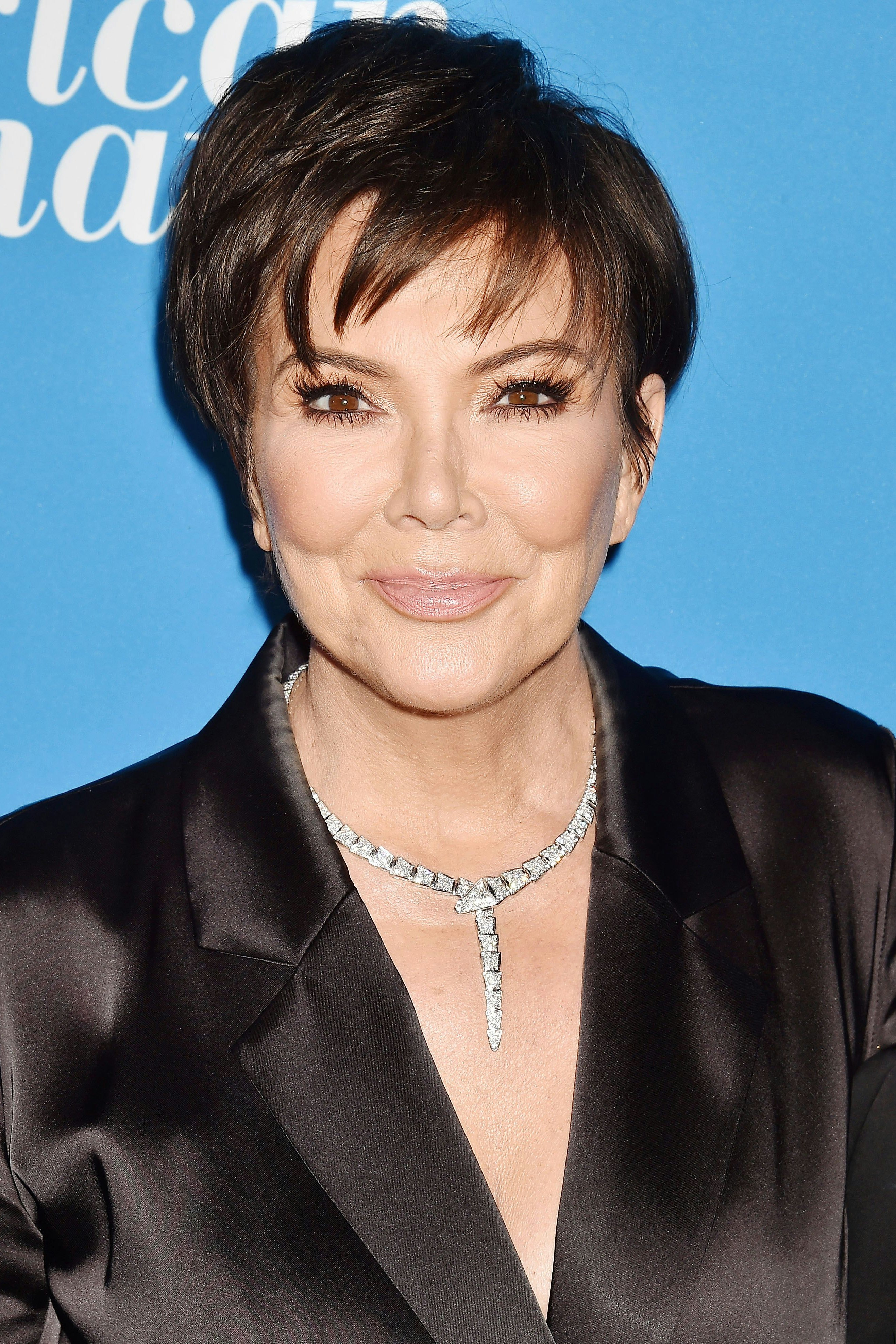 Kris Jenner, Mutter des Kardashian-Clans vor und nach ihrem Deep-Plane-Facelifting (unten)