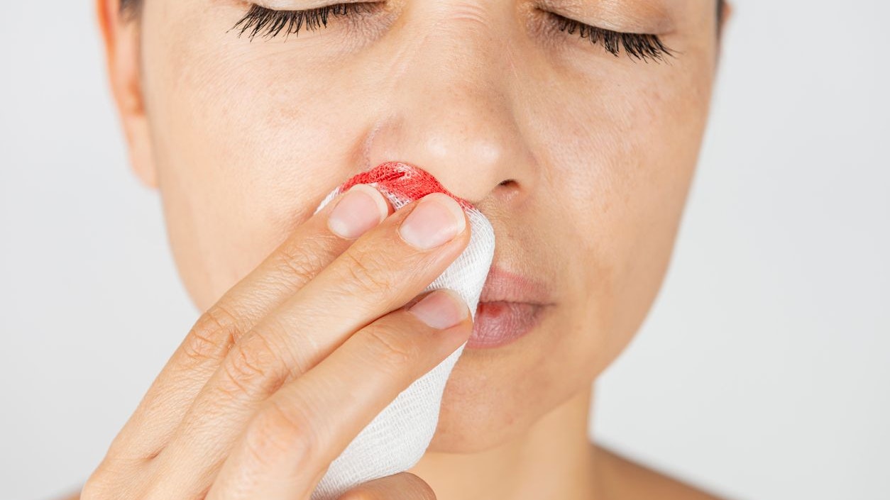 Woman using a sterile gauze bandage to stop a nosebleed.