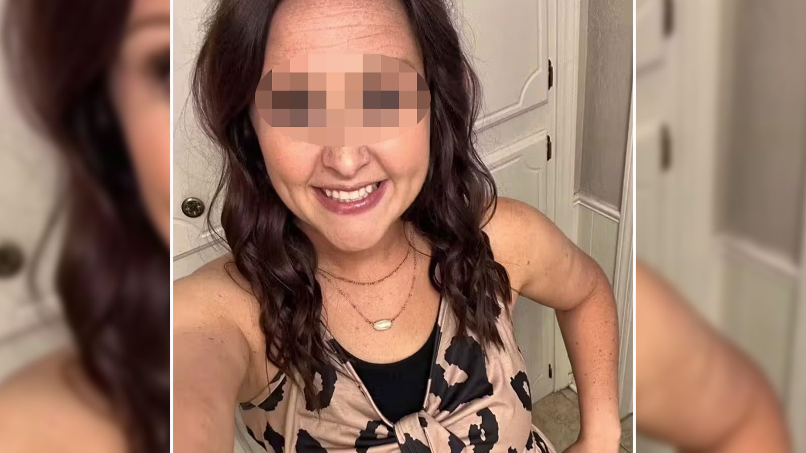 Die 30-Jährige aus Oklahoma starb zweieinhalb Jahre später nach über 60 Operationen.