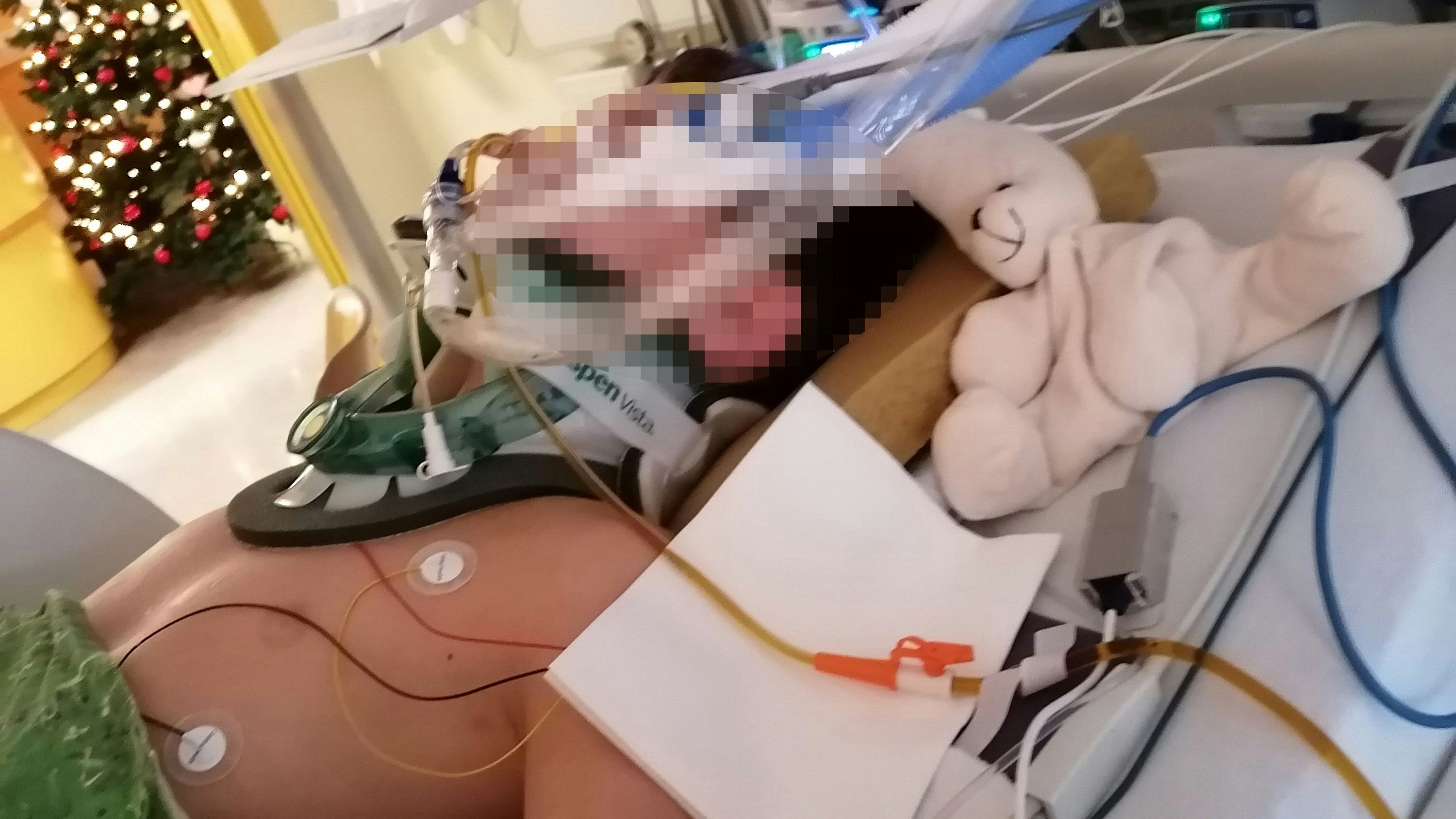 Max wurde eine Woche lang in ein künstliches Koma versetzt.