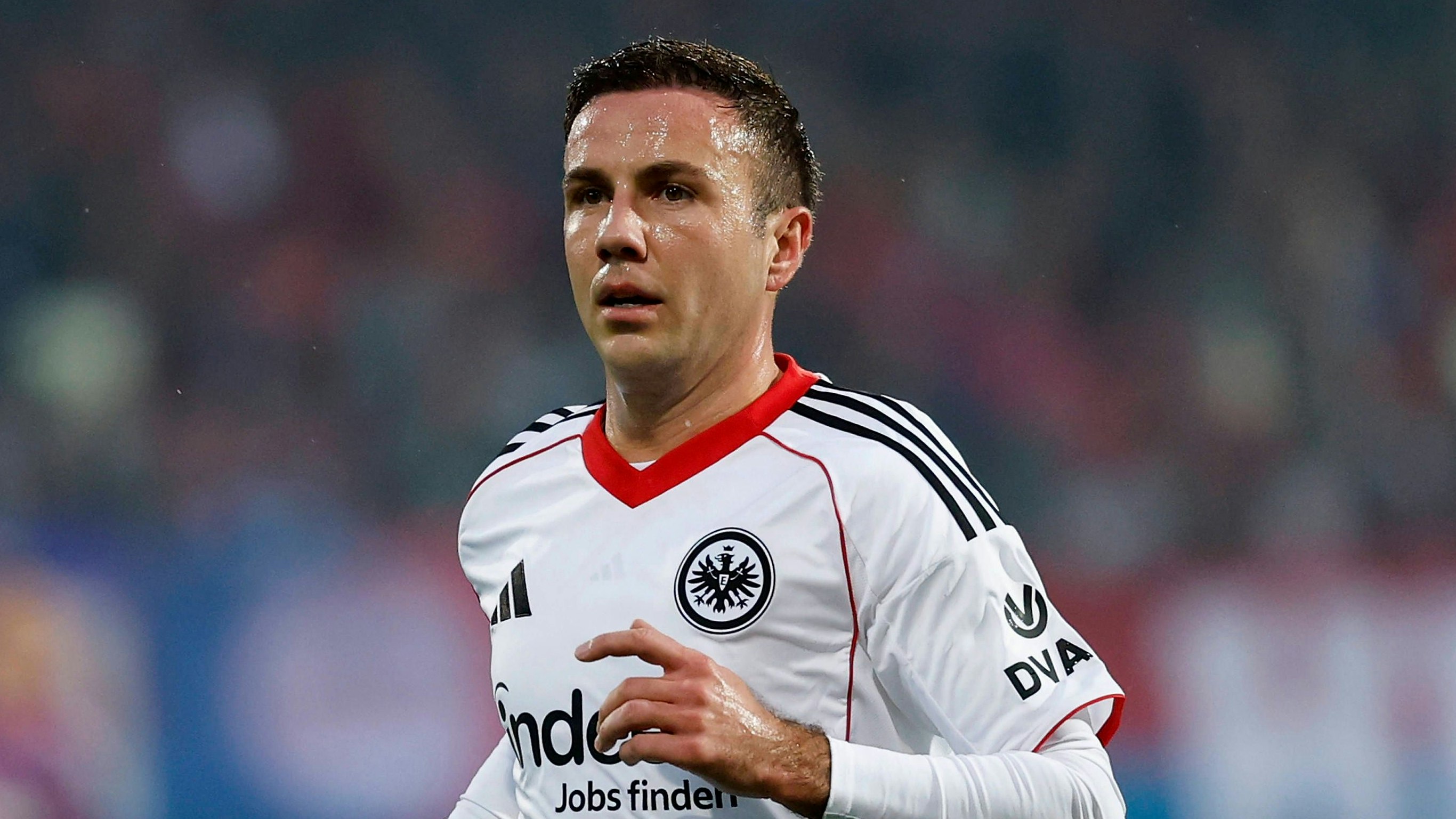 Heute.at - WM-Held spricht erstmals über Haar-Transplantation