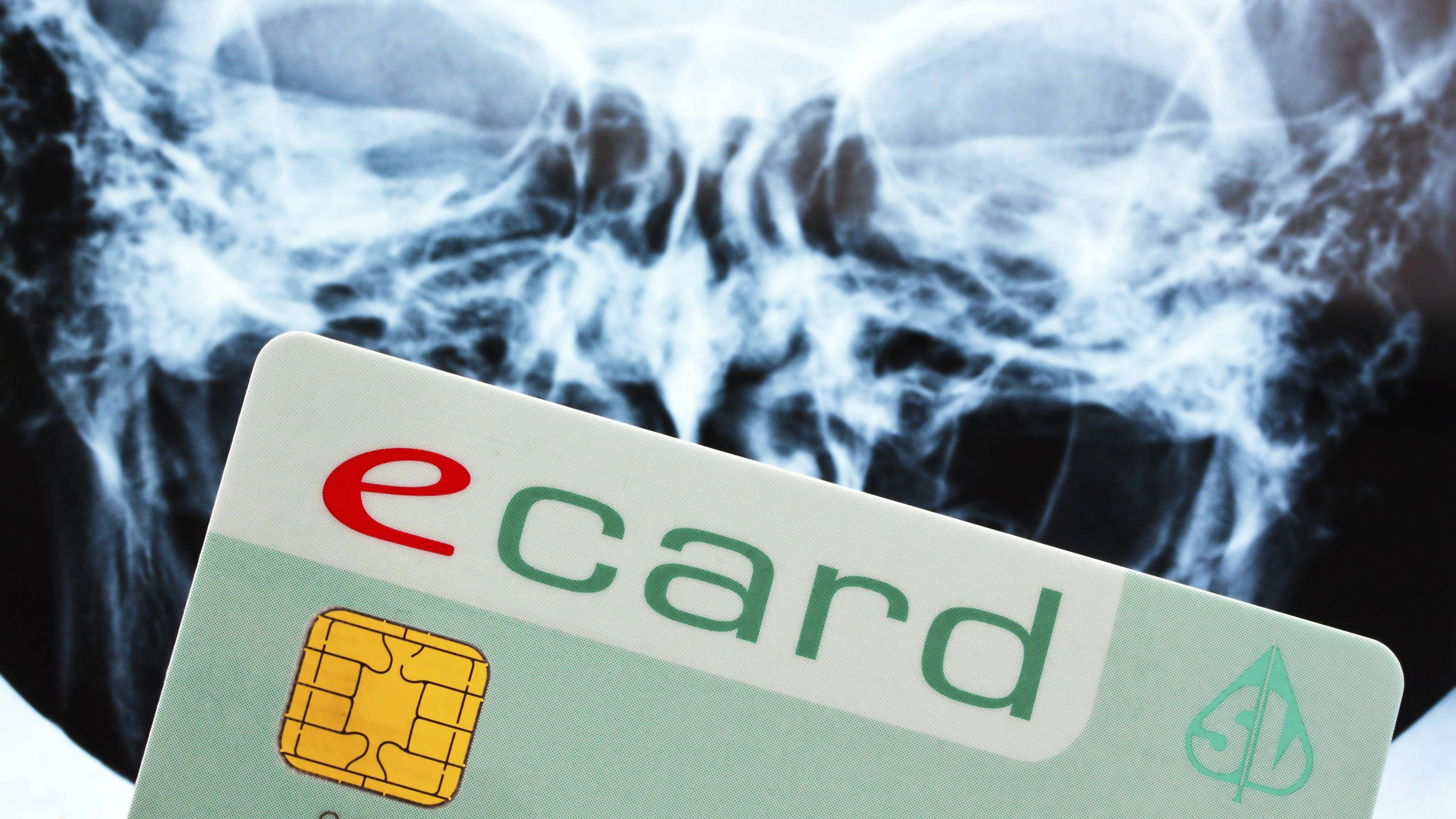 Die E-Card dient zur Abrechnung der Arztrechnungen der österreichischen Krankenkassen.