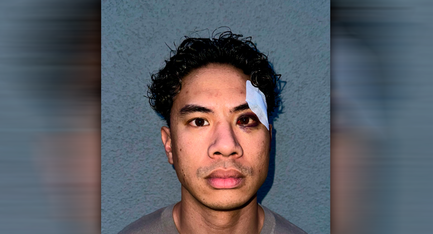 Heute.at - Schlitzauge – Comedian auf offener Straße verprügelt