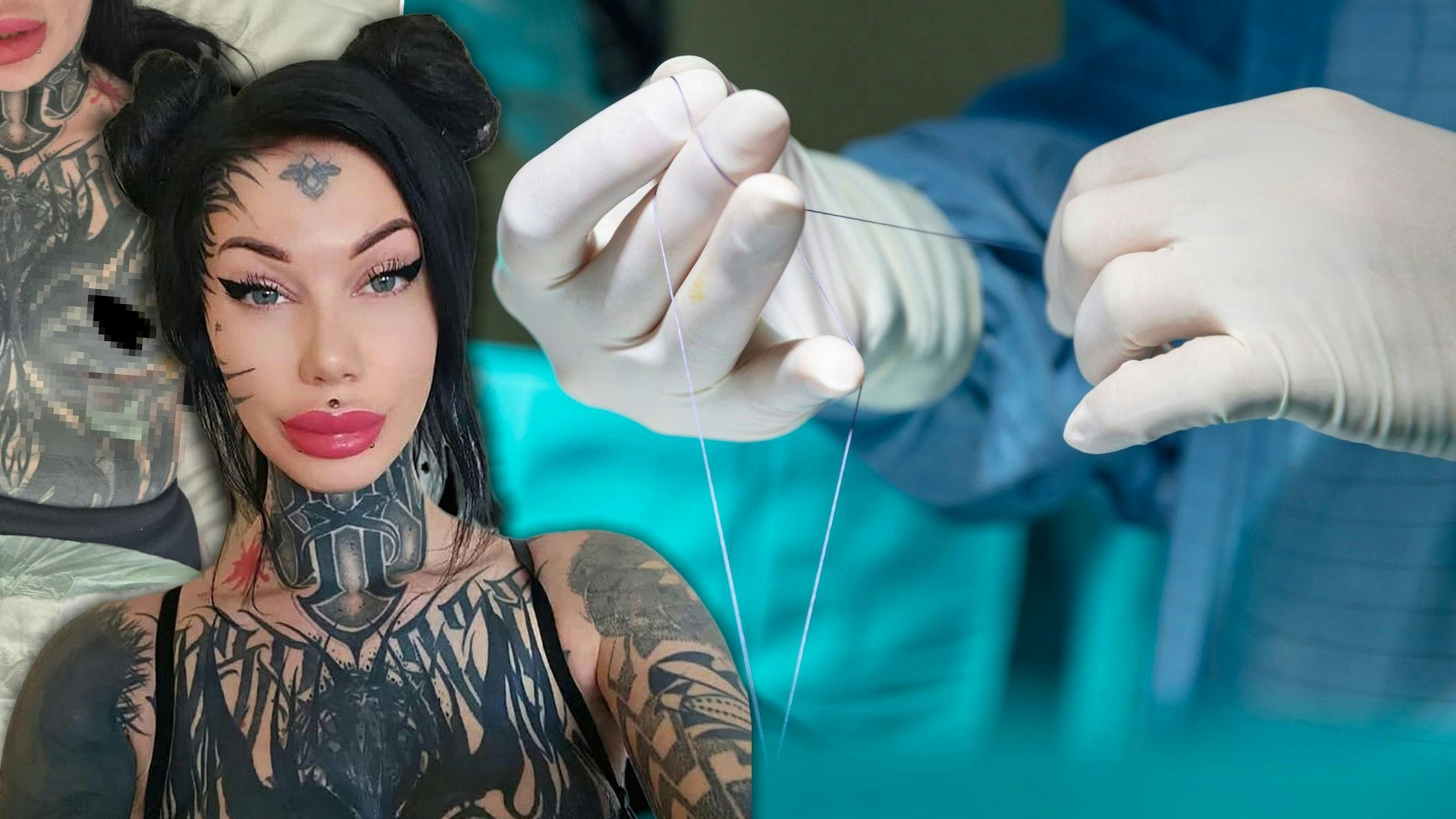 Heute.at - Wienerin kann nach Pfusch-OP nicht mehr arbeiten