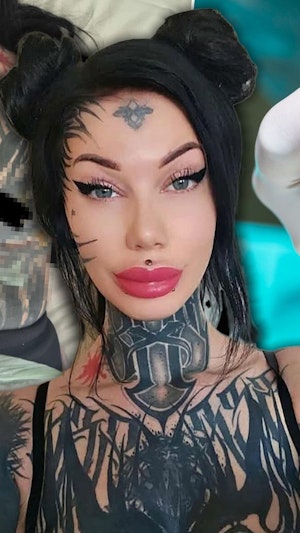 Brust-OP-Komplikationen: Wiener Patientin erlebt nach Schönheitsoperation in Prag schwere gesundheitliche und finanzielle Folgen. Aktuelle Details.