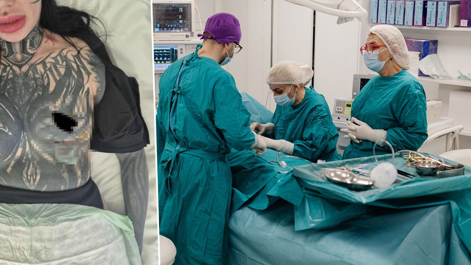 Heute.at - Wienerin (26) hat nach Horror-OP nur noch eine Brust