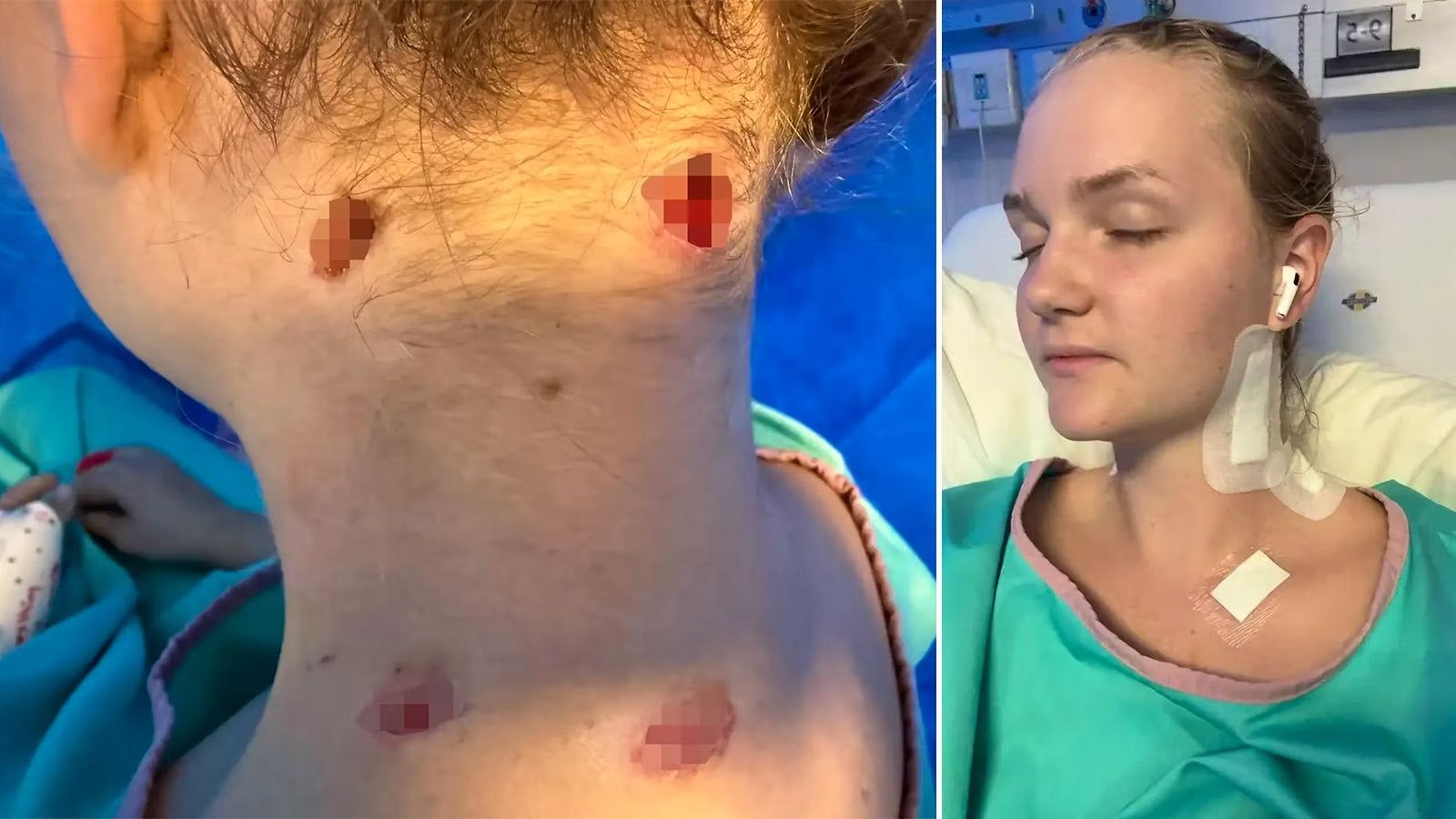 Heute.at - Naemi (21) überlebt Löwen-Attacke auf Safari