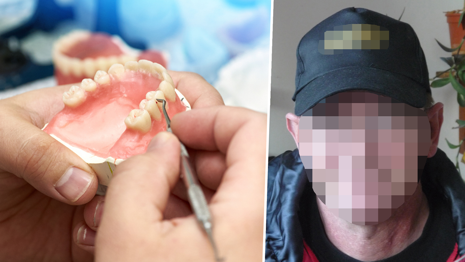 Der 61-Jährige spart schon seit über einem Jahr, um sich die Implantate leisten zu können. (Symbolbild)