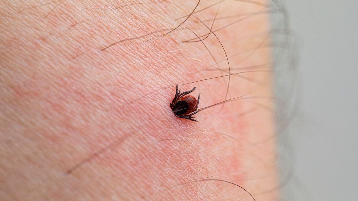 Heute.at - Fleischallergie nach Zeckenstich – Erster Todesfall