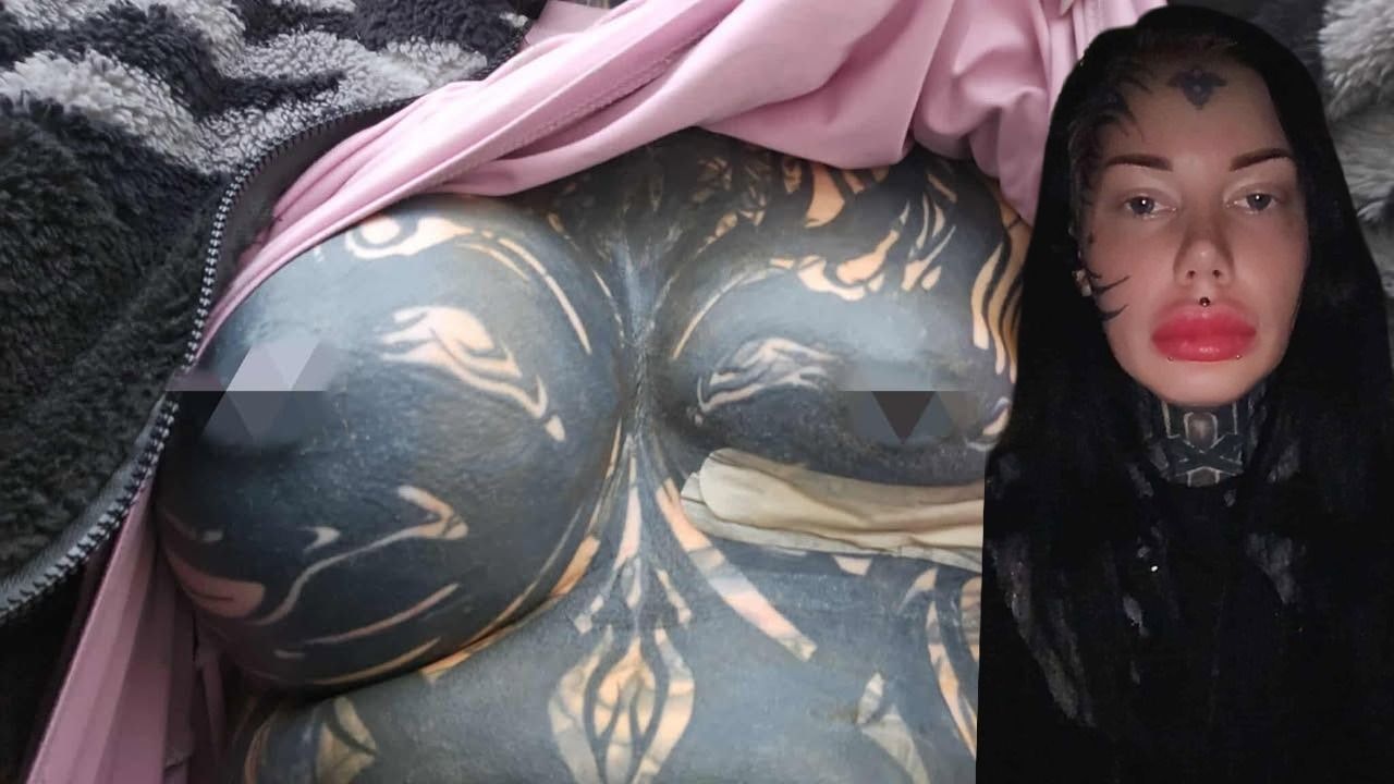 Heute.at - Wienerin (26) nach Albtraum-OP komplett entstellt