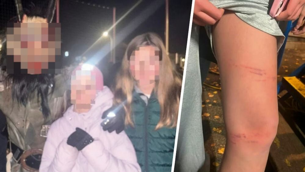 Die 13-Jährige (r., in Grün) mit ihrer Schwester und einem der Perchtenlauf-Teilnehmer. Das zweite Bild zeigt einige ihrer Blessuren.