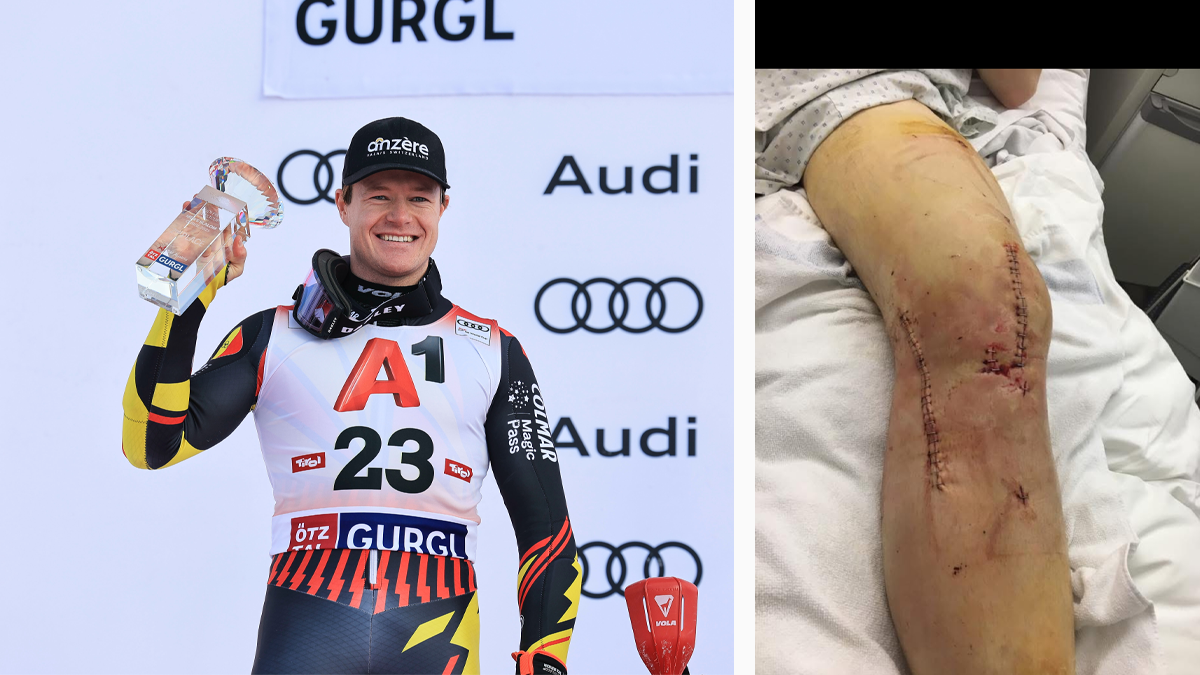 Armand Marchant überstand eine schlimme Verletzung.