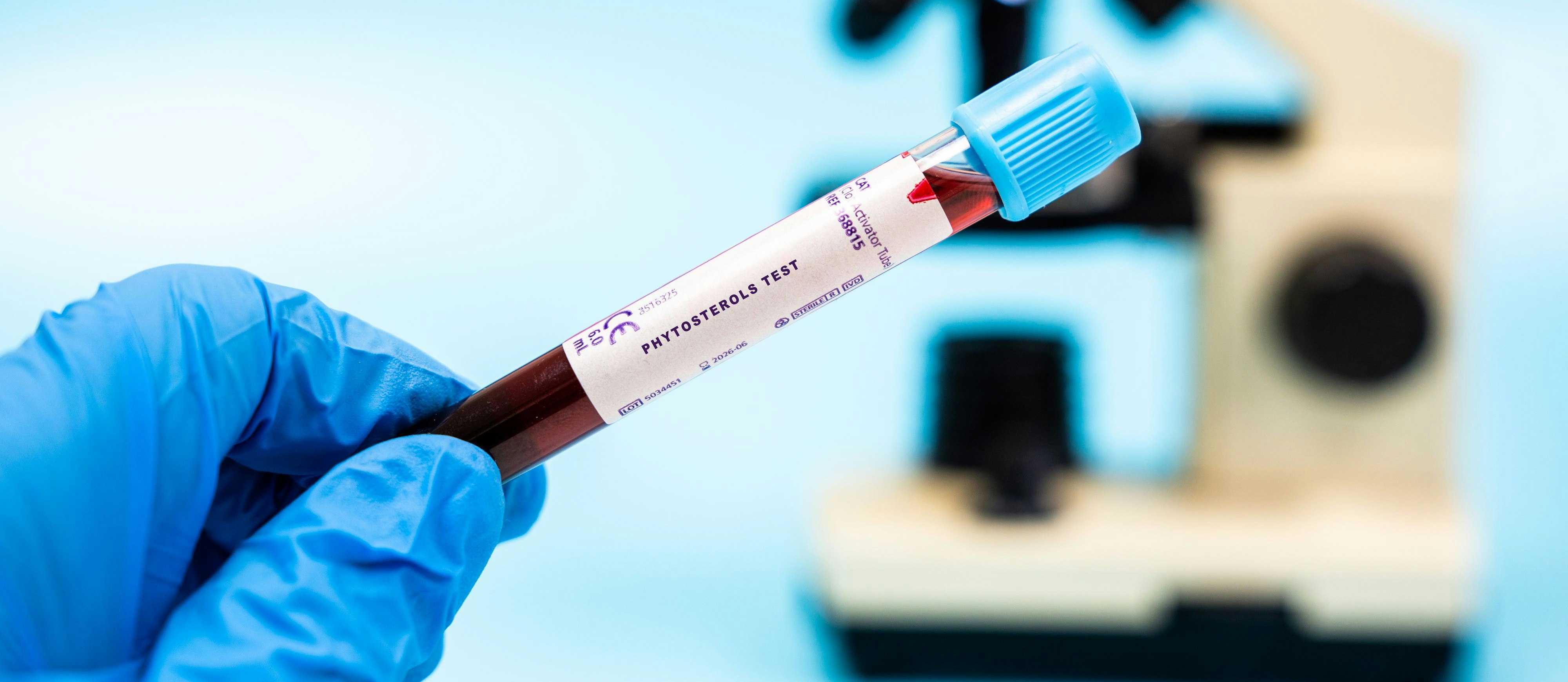 Die Standardmessung des „schlechten” Cholesterins berücksichtigt die risikoreichste Form davon nicht