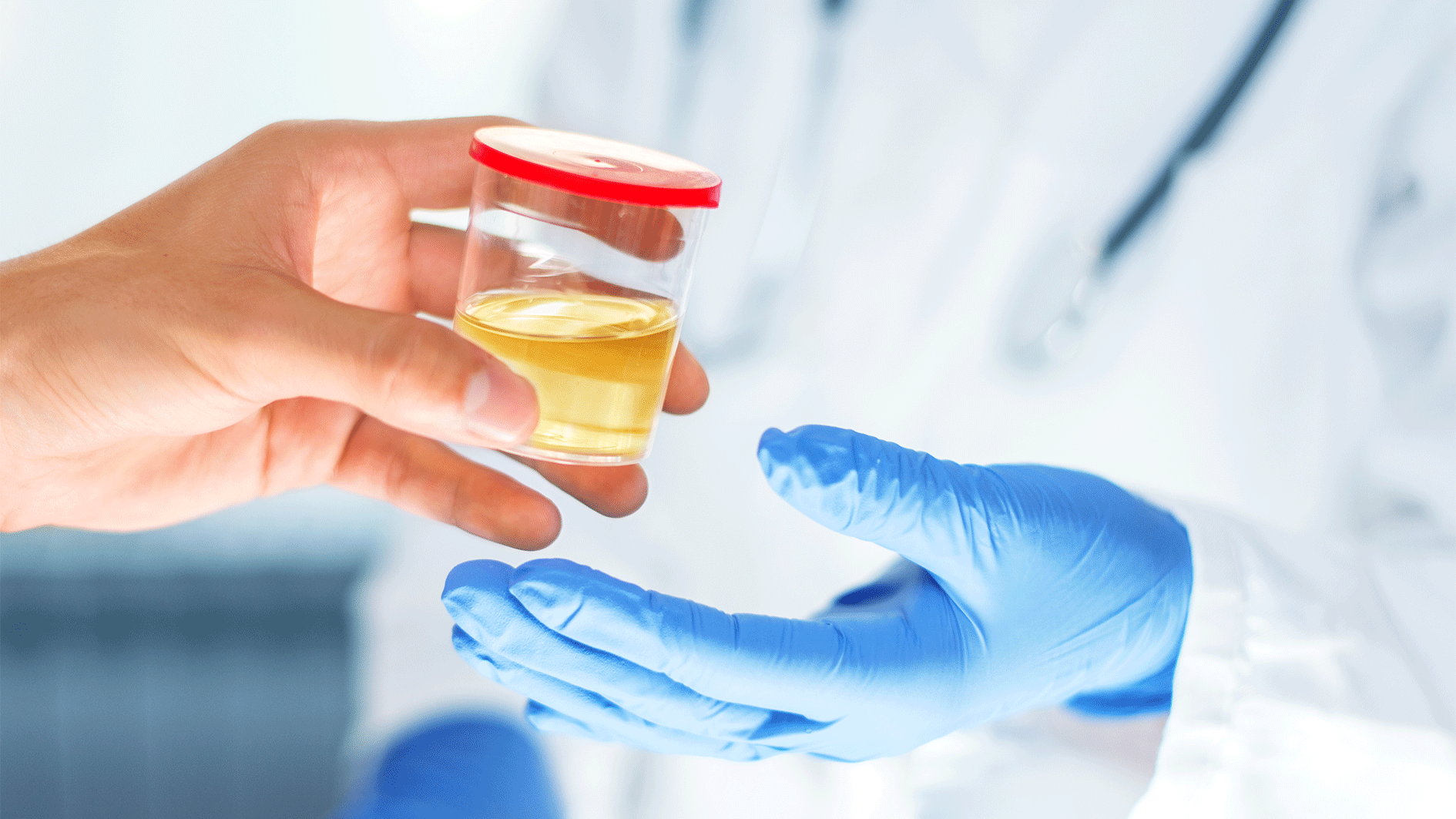 Heute.at - Neue Studie – Urin könnte Demenzrisiko vorhersagen