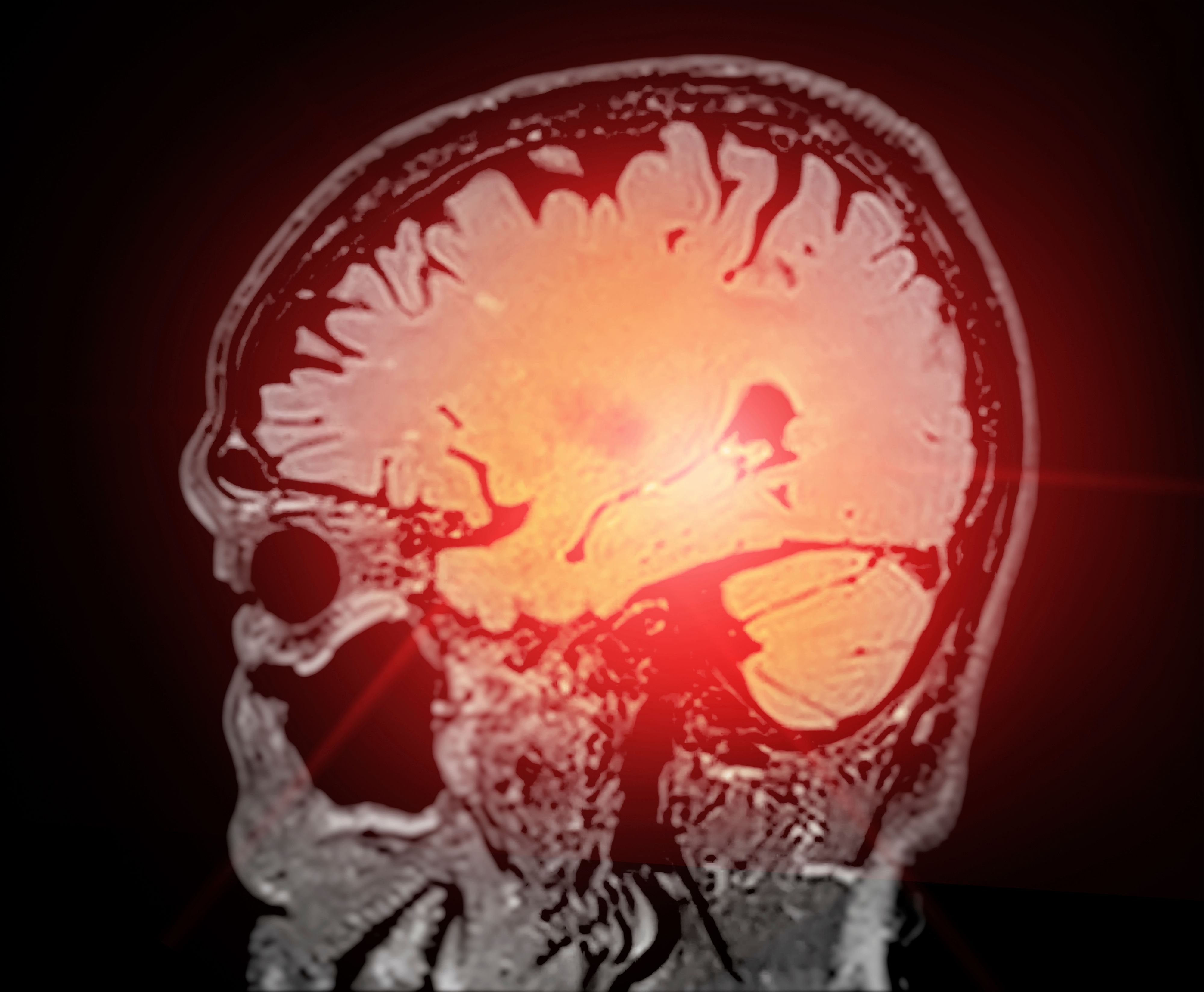 Heute.at - Wie sich das Gehirn im Laufe des Lebens verändert