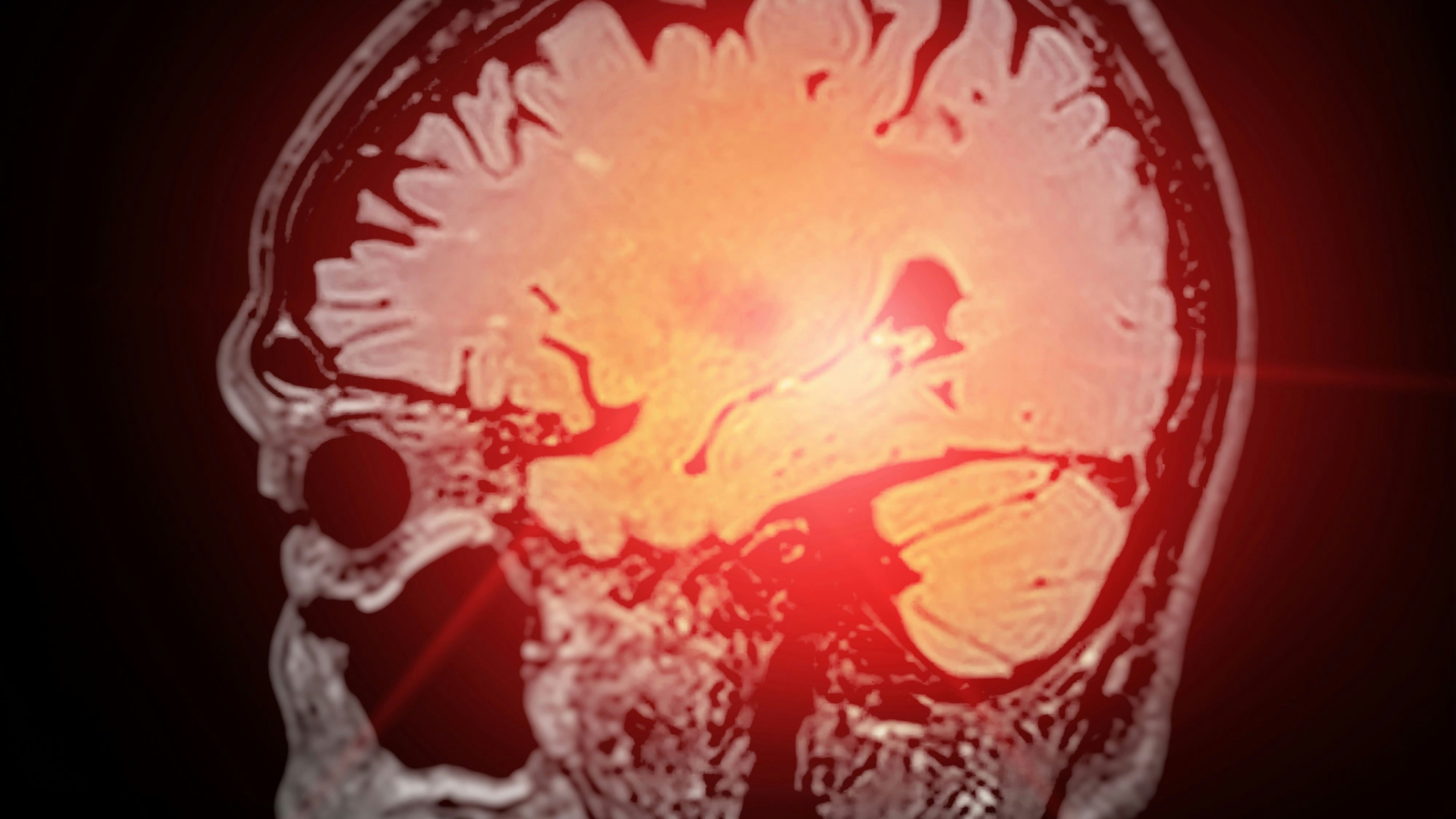 Heute.at - Wie sich das Gehirn im Laufe des Lebens verändert