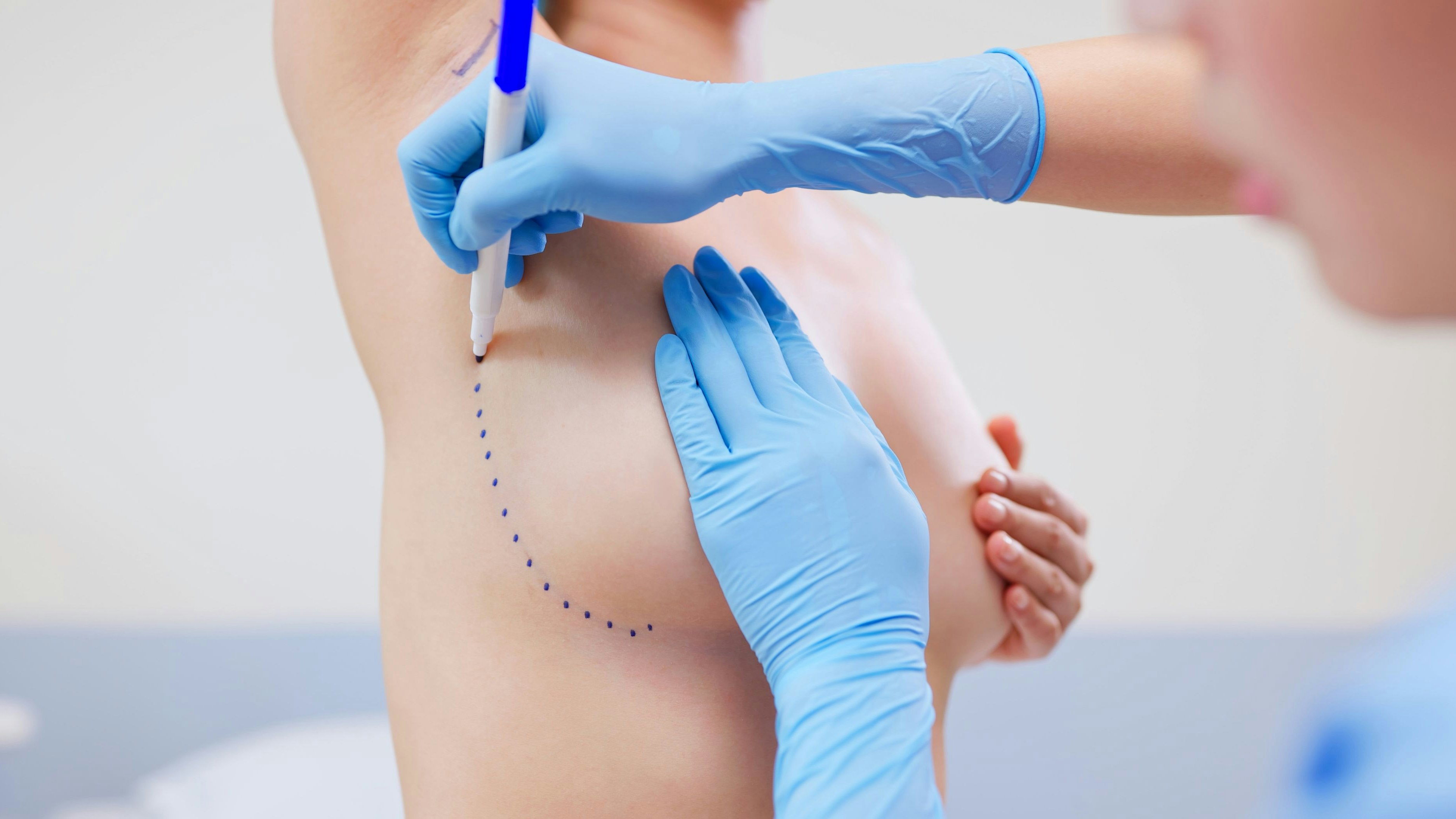 Heute.at - Brust-OP: Wie verhindert man eine Kapselfibrose?