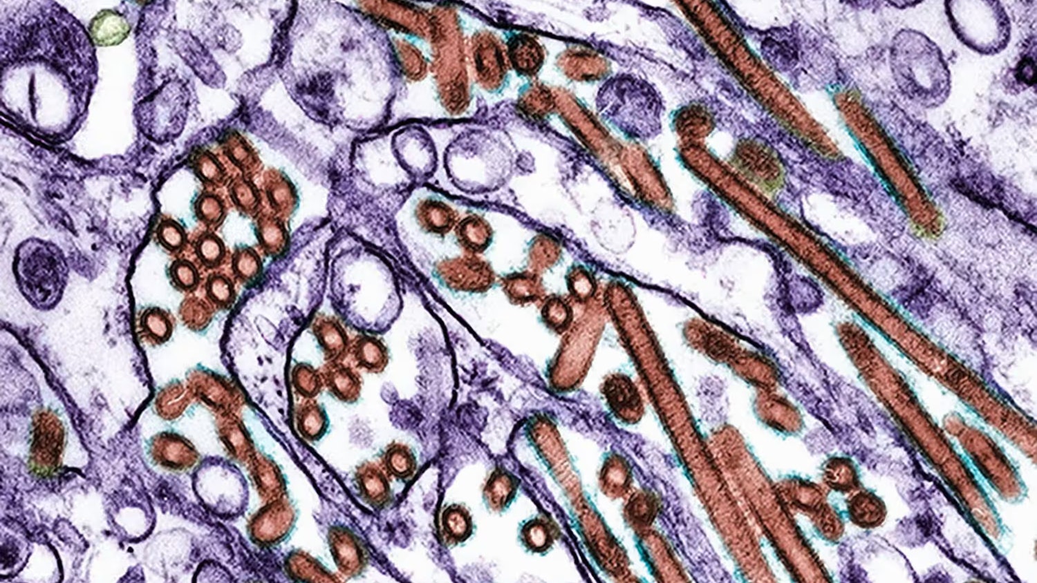 Heute.at - Schlimmer als Covid-19 – Warnung vor neuer Pandemie
