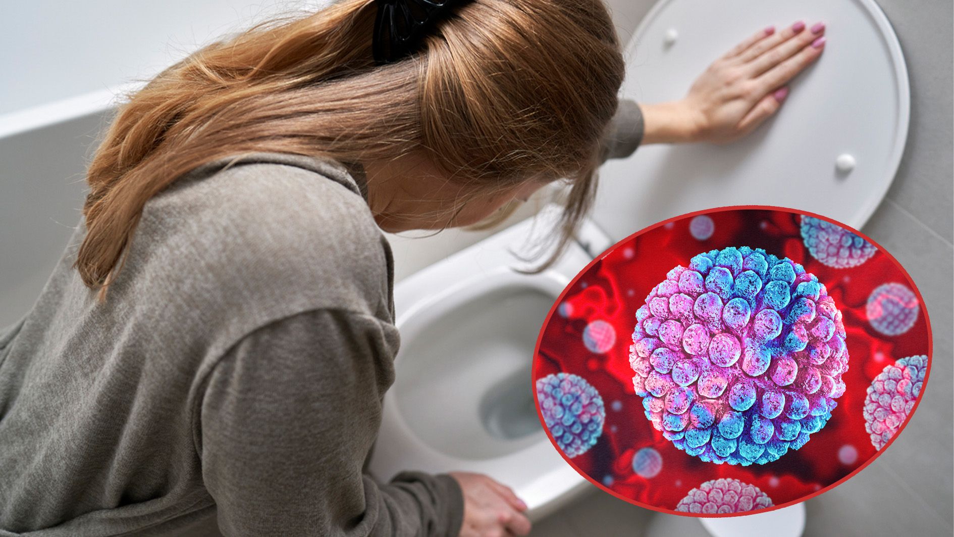 Plötzliches Erbrechen, wässriger Durchfall, Bauchkrämpfe – typisch Norovirus. Die Symptome beginnen meist 12 bis 48 Stunden nach Ansteckung und sind hoch ansteckend.
