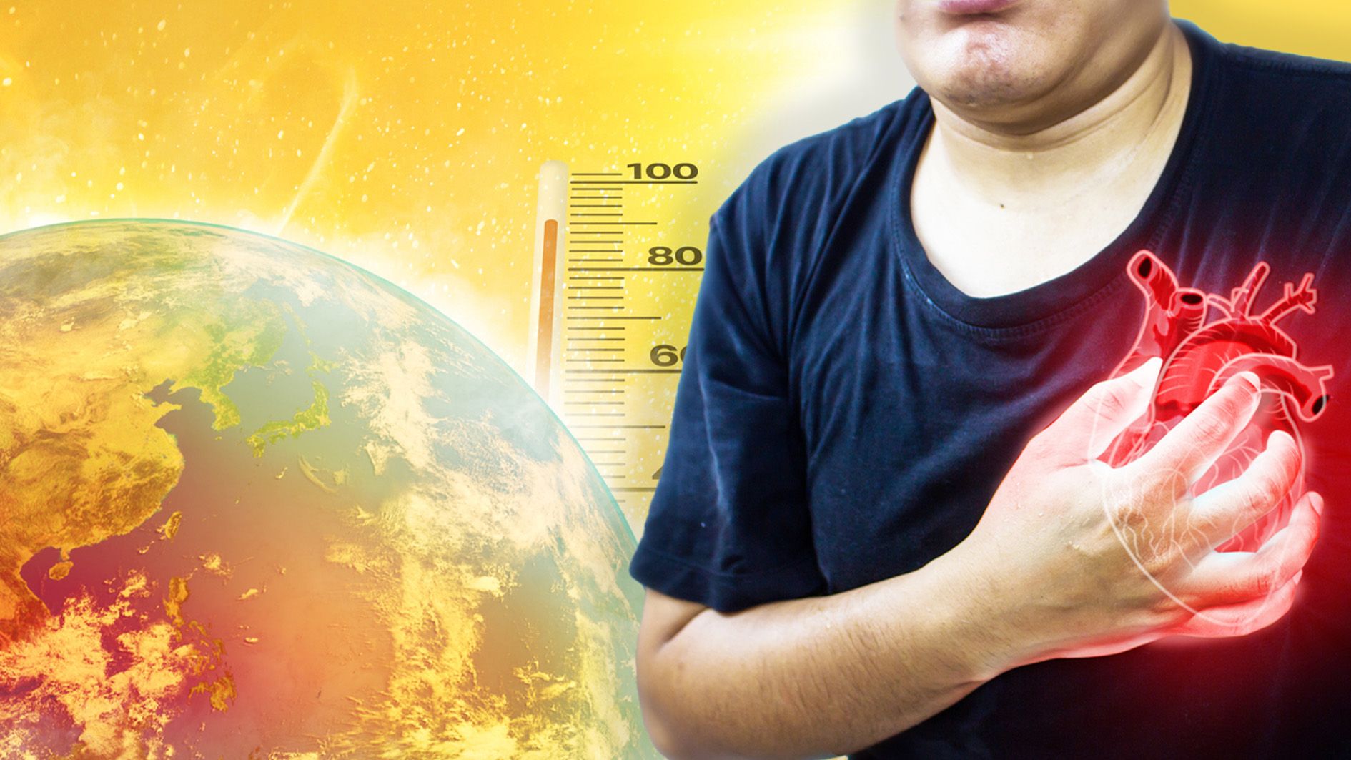 Extremtemperaturen als Herz-Falle: Vorhofflimmern wird häufiger und länger.