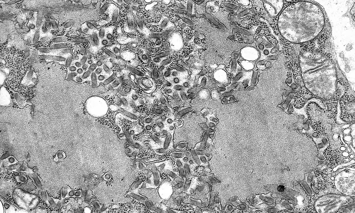 Heute.at - Nach Nieren-Transplantation – Mann stirbt an Tollwut