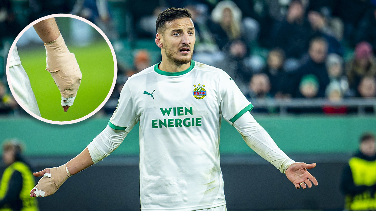 Rapid-Star Ercan Kara erlitt während des Spiels einen Handbruch. 
