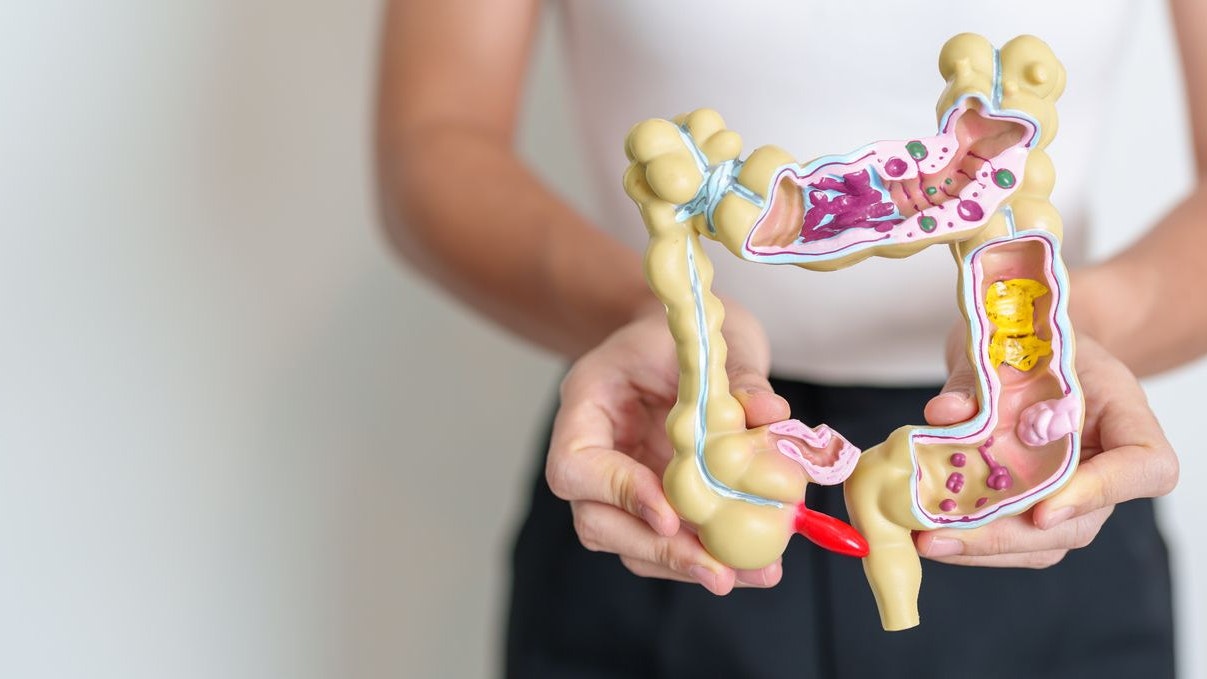 Woman holding human Colon anatomy model. Colonic disease, Large Intestine, Colorectal cancer, Ulcerative colitis, Diverticulitis, Irritable bowel syndrome, Digestive system and Health concept
