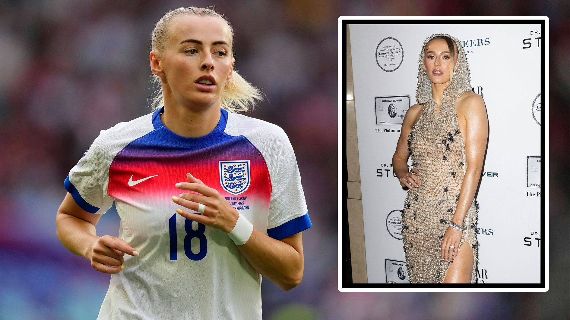 Fußball-Beauty mit Haarausfall: "Hatte Angstzustände"