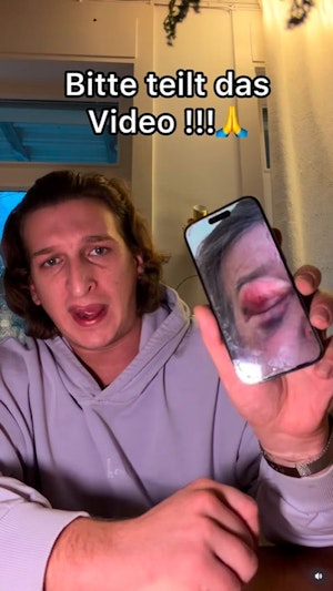 Jugendbande verprügelt Vater von Satansbratan in Wien-Favoriten schwer. Polizei ermittelt, Zeugen werden dringend gesucht. Alle Infos zum Vorfall.