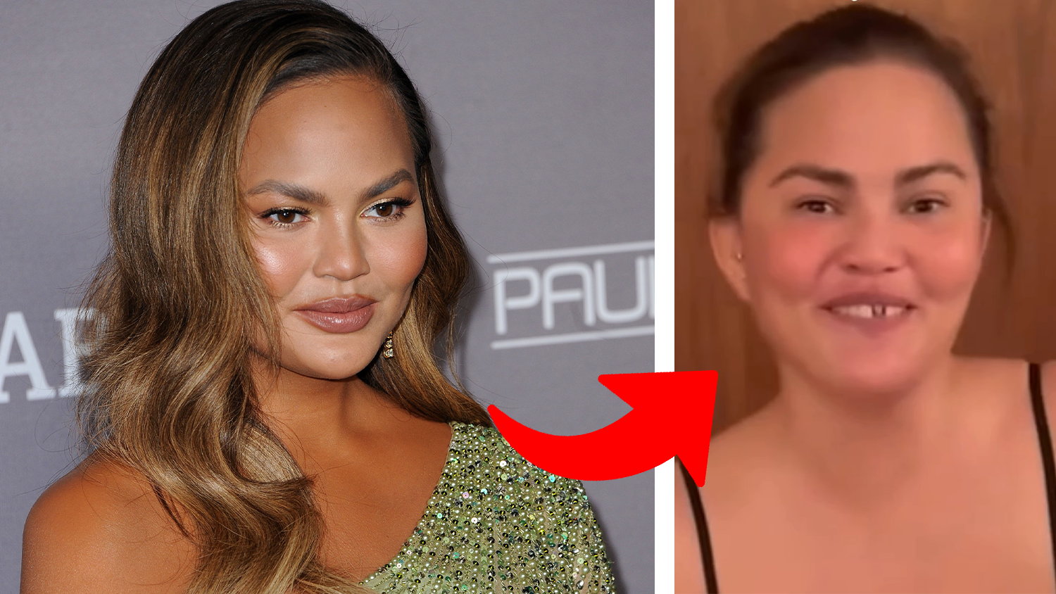 Heute.at - Kurz vor Weihnachten! Model verliert ihren Zahn